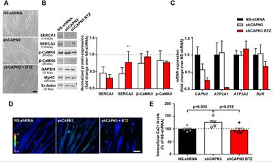 Targeting the Ubiquitin-Proteasome System in Limb-Girdle Muscular Dystrophy With CAPN3 Mutations